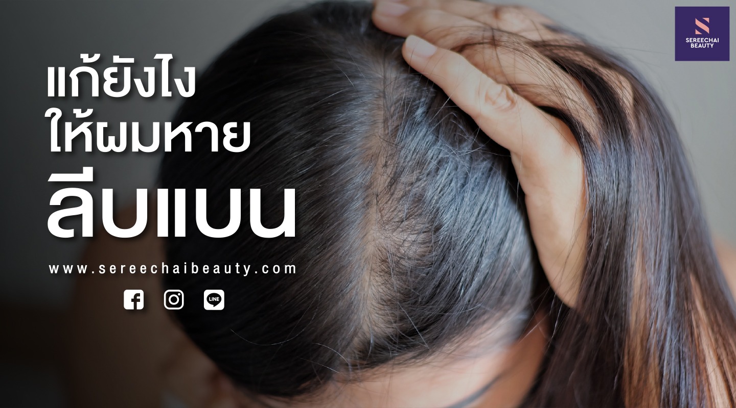 แก้ยังไงให้ผมหายลีบแบน - เสรีชัยบิวตี้